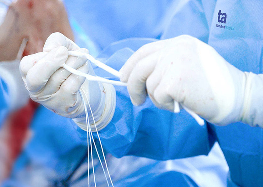 Dây chằng nhân tạo có độ tương thích sinh học với cơ thể và độ bền rất cao