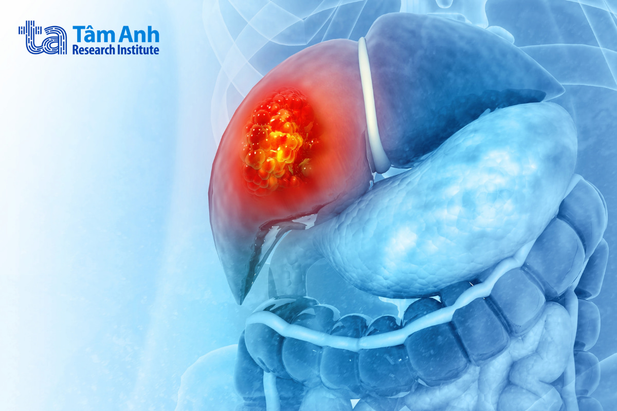 Có 36% bệnh nhân điều trị bằng nivolumab kết hợp ipilimumab đạt đáp ứng khách quan được xác nhận